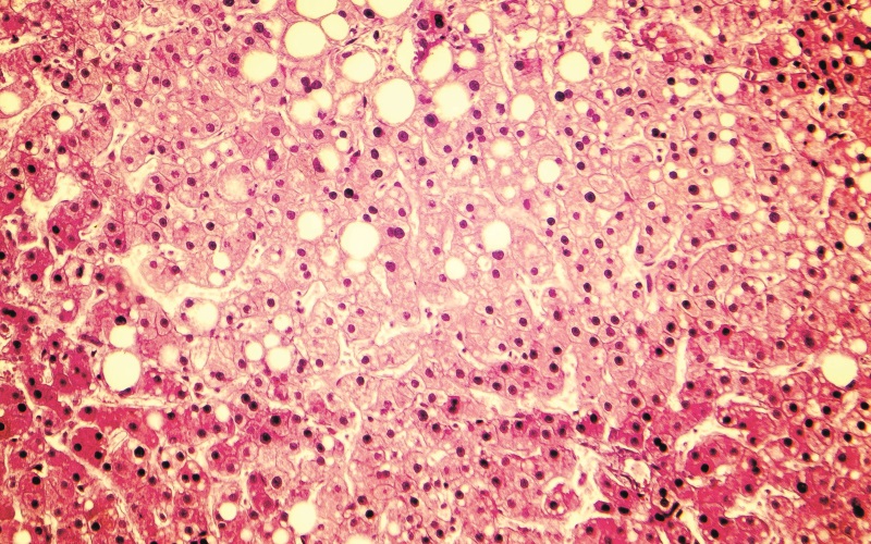 Growing human liver cells ‘in a dish’