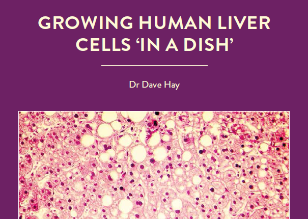 Full liver transplants are the main treatment option for severe liver disease, but suitable donors are in short supply. Could stem cell technology, in which healthy liver […]
