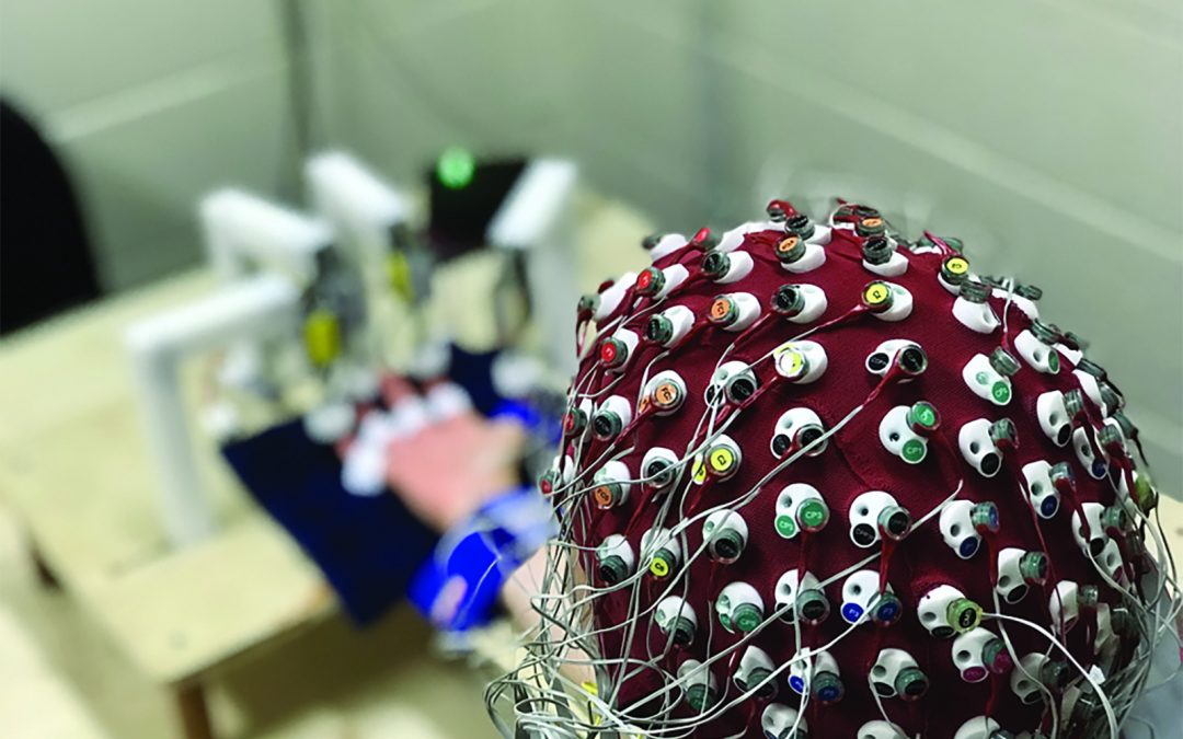 What if electrical stimulation could treat phantom limb pain?