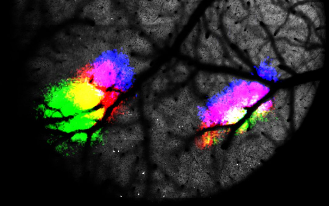 Can we control the electrical activity in our brains?