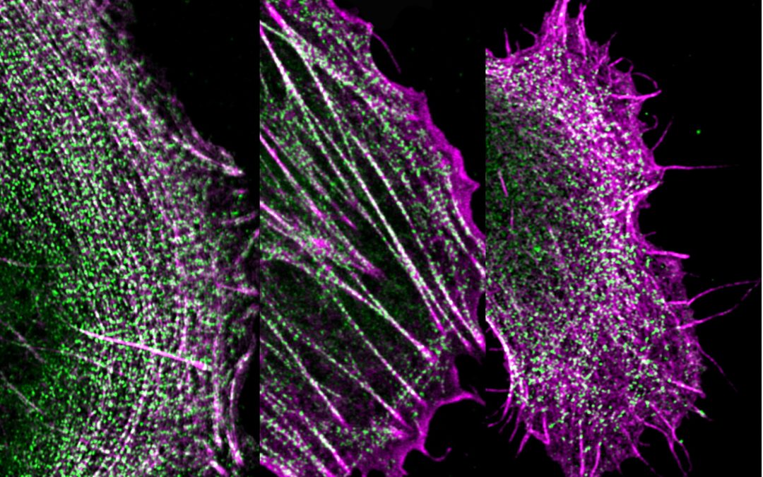 Imaging the invisible: how can research software and imaging techniques help scientists study the things we can’t see?