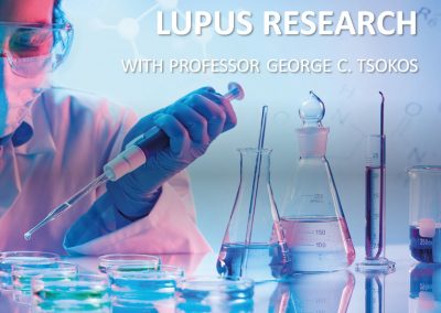 Lupus Research