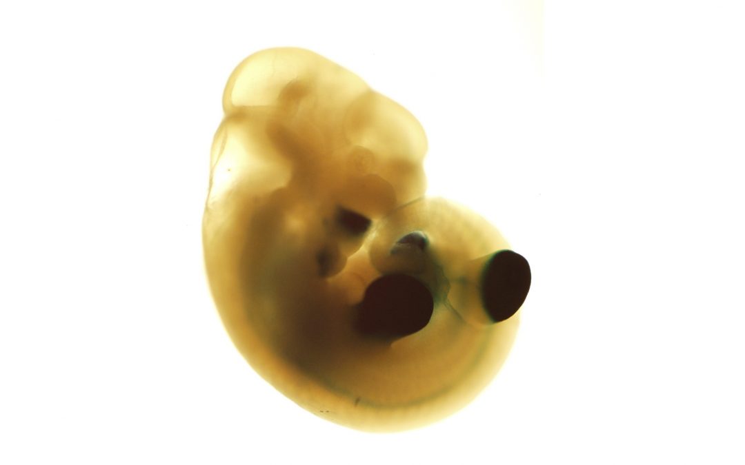 Why do males and females have different risks of disease?