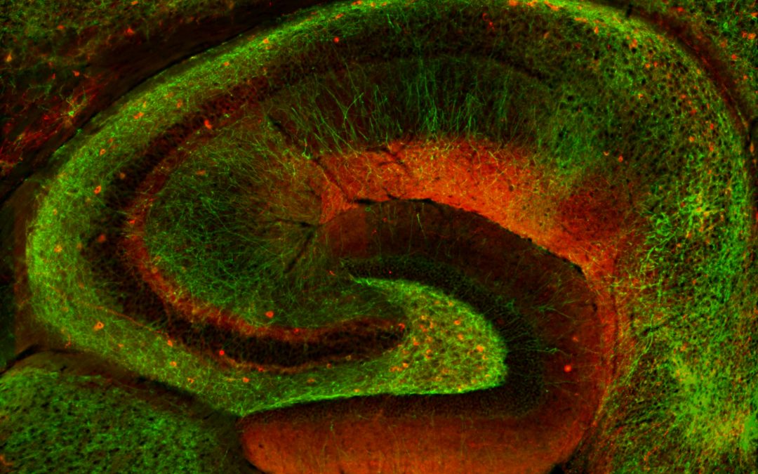 The importance of memory in severe mental illness