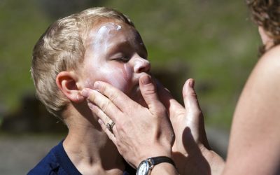 Why schools need to take sun safety more seriously