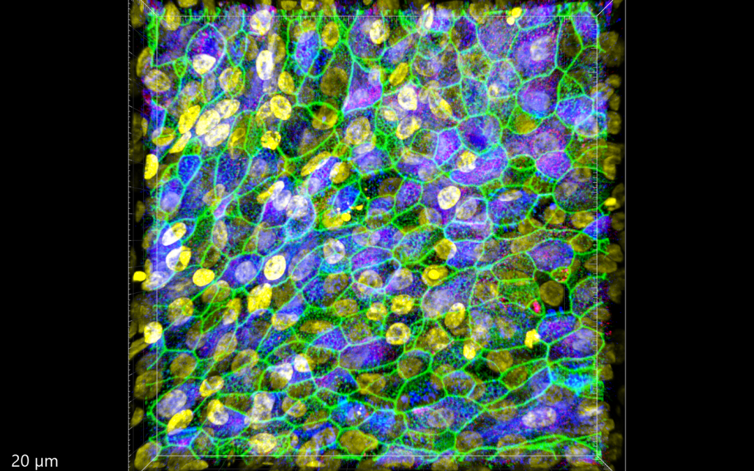 A new paradigm in antibiotic research