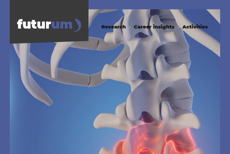 Improving treatment options for people with ankylosing spondylitis