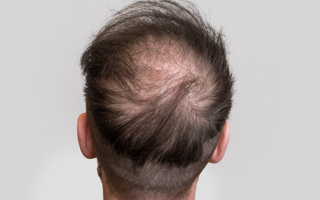 The history of hair: tracing its roots to early origins