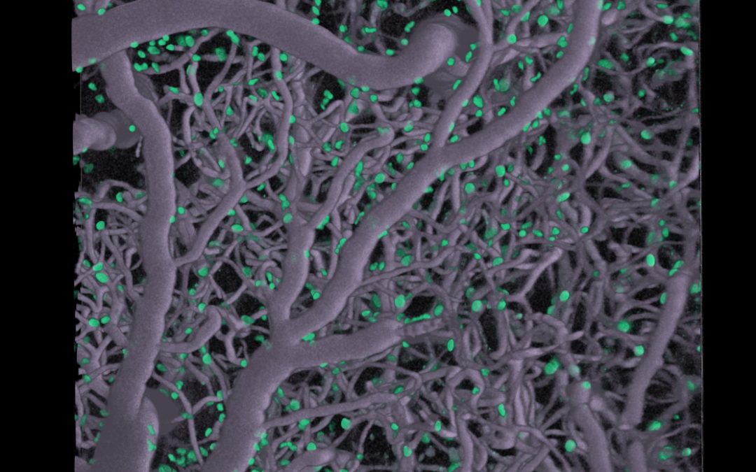 Can functional imaging and image-guided therapy revolutionise treatments for neurological disorders?