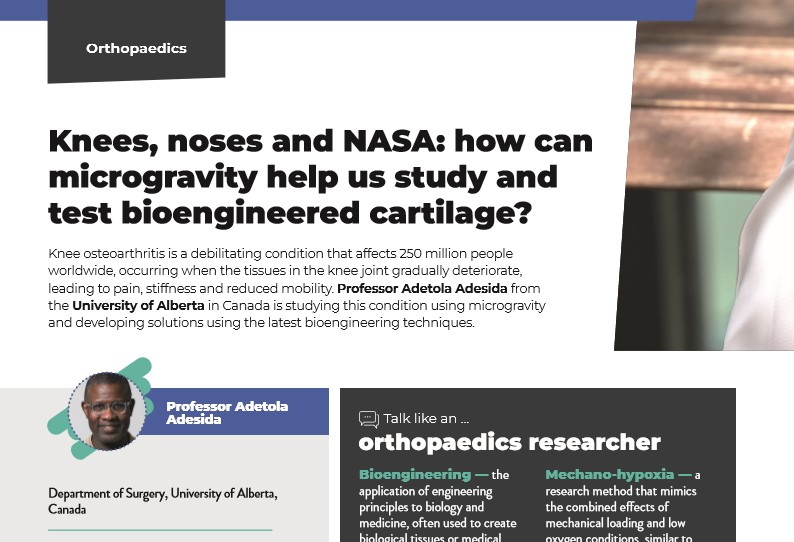 Knees, noses and NASA: how can microgravity help us study and test bioengineered cartilage?