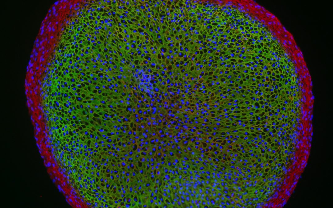 Knees, noses and NASA: how can microgravity help us study and test bioengineered cartilage?