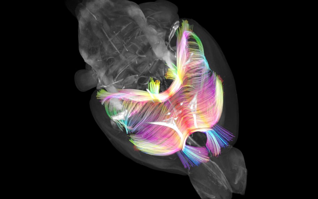 Unlocking new neuroscience frontiers by imaging the intricacies of the mouse brain