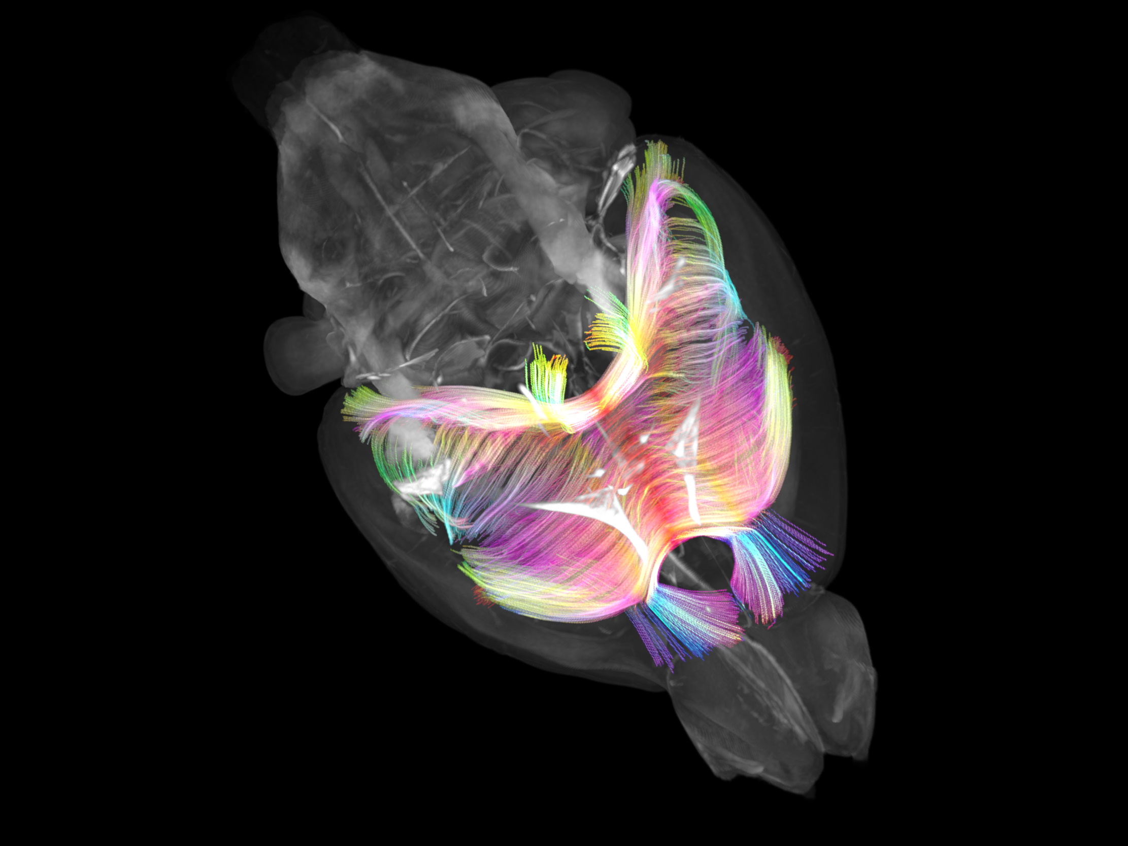 Unlocking new neuroscience frontiers by imaging the intricacies of