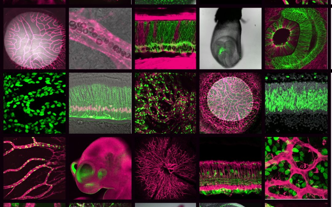 How do rare genetic disorders affect vitamin B12 metabolism and embryonic development?