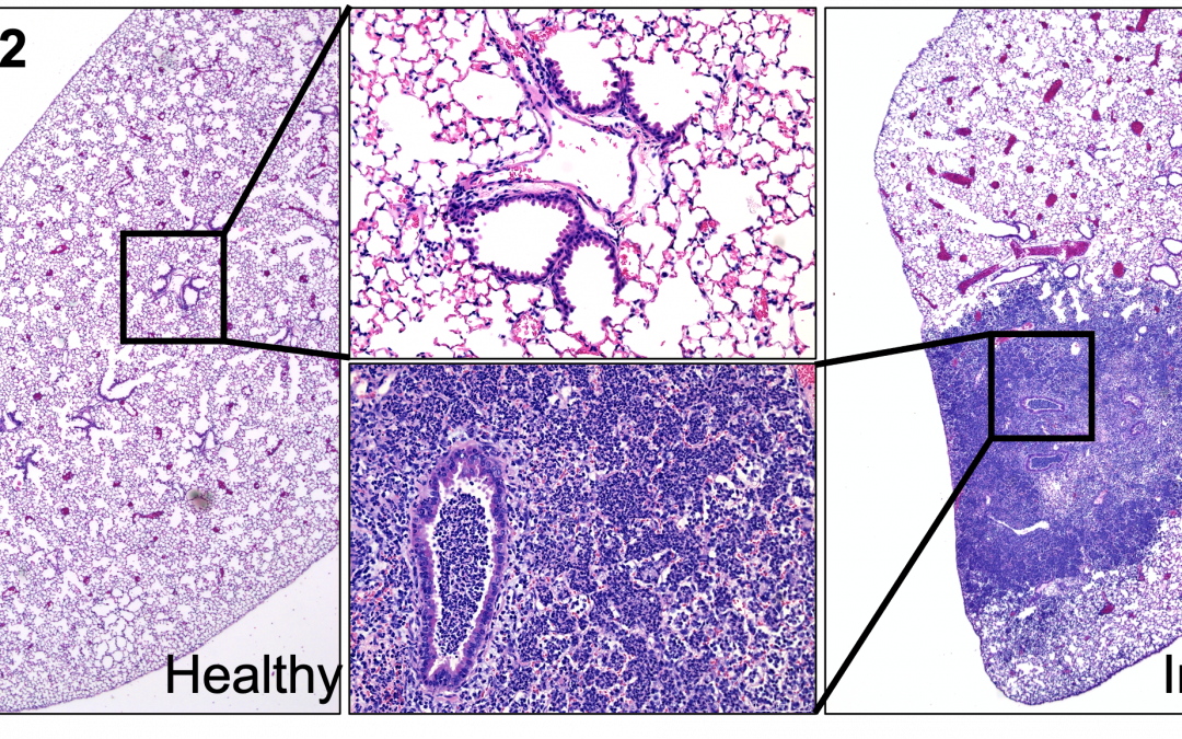 Breath by breath: how T cells protect our lungs from infection