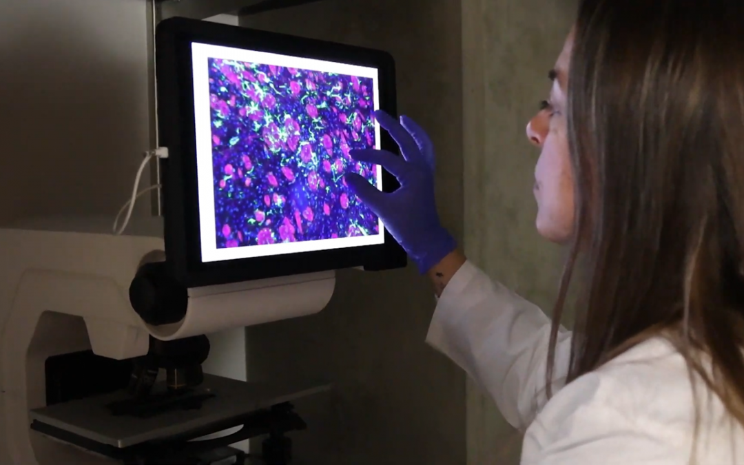 The molecular mechanisms behind a devastating disease