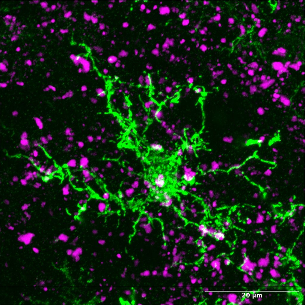 A microscope image of synapses