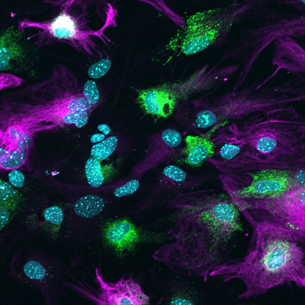 As elevated levels of C4A