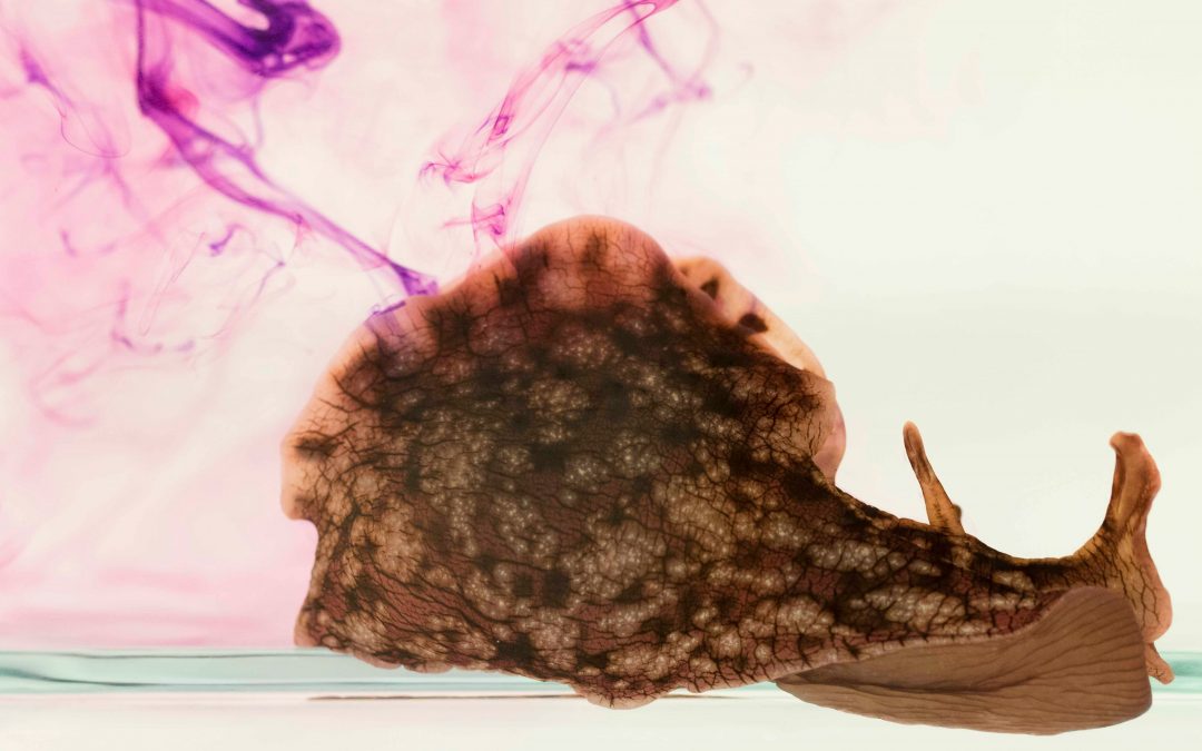 How are sea slugs helping us understand human health conditions?